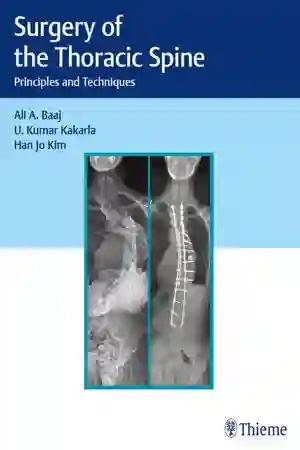 Surgery of the Thoracic Spine (Color)