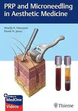 PRP and Microneedling in Aesthetic Medicine (Color)