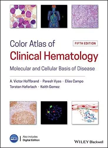 Hoffbrand Color Atlas Of Clinical Hematology (Color)