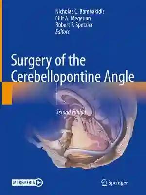 Surgery of the Cerebellopontine Angle (Color)