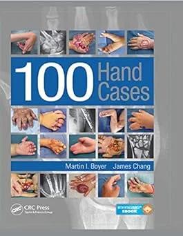 100 Hand Cases (Color)