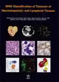 Who Classification of Tumours of Hematopoietic and Lymphoid Tissues