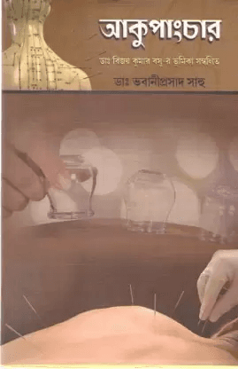 আকুপাংচার