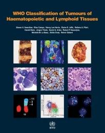 WHO Classification of Tumours of Haematopoietic and Lymphoid Tissues (Color)