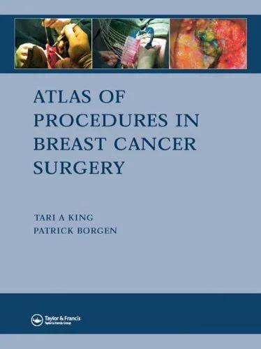 Atlas of Procedures in Breast Cancer Surgery (Color)