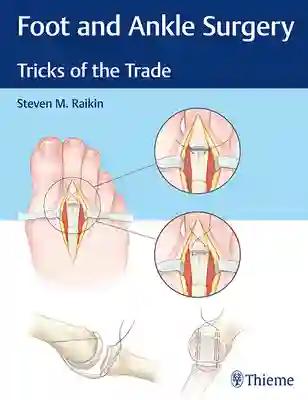 Foot and Ankle Surgery (Color)