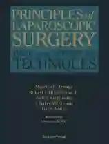 Principles of Laparoscopic Surgery: Basic and Advanced Techniques