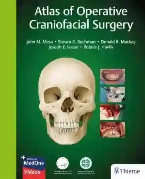 Atlas of Operative Craniofacial Surgery (Color)