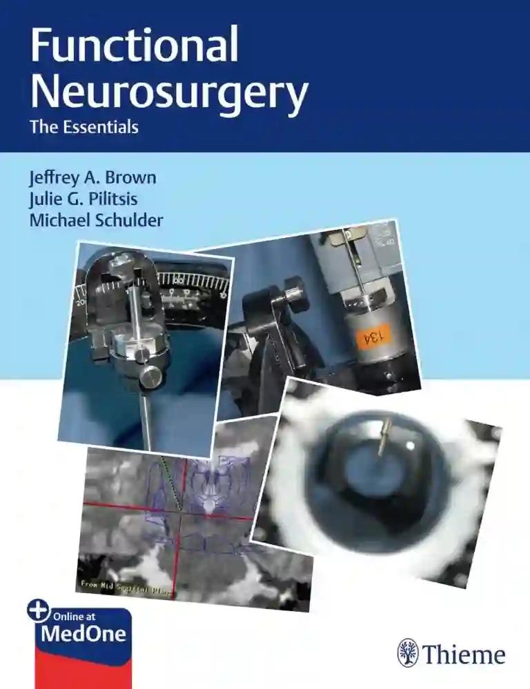 Functional Neurosurgery (Color)
