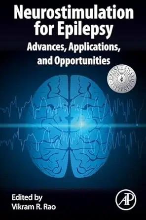 Neurostimulation for Epilepsy (Color)